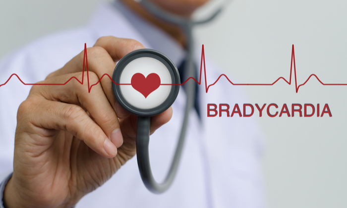 หัวใจเต้นช้ากว่าปกติ (Bradycardia)