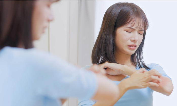 ลูปัสที่ผิวหนัง (cutaneous lupus) สาเหตุ อาการ การรักษา