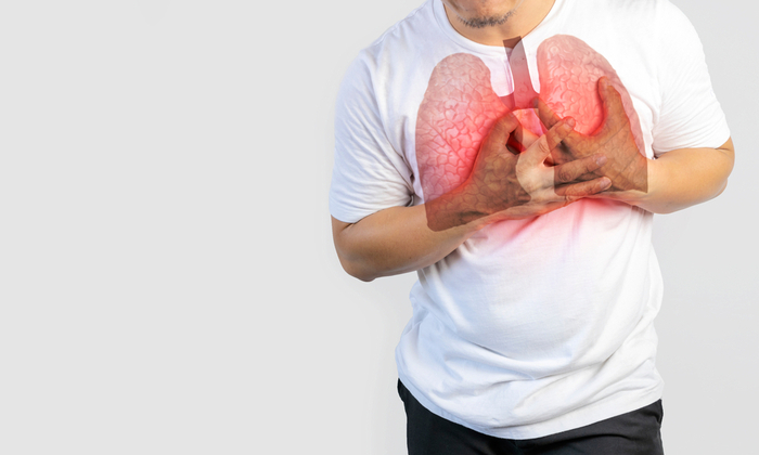 5 พฤติกรรมเสี่ยงต่อการเกิดโรคถุงลมโป่งพอง