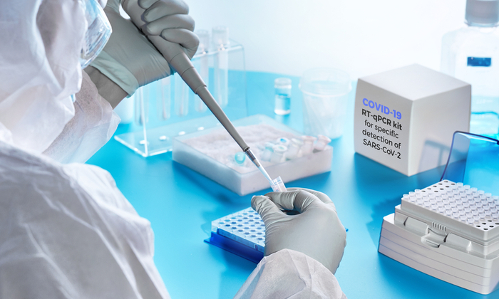 ไขข้อข้องใจ การตรวจเชื้อโควิด แบบ RT-PCR คืออะไร?