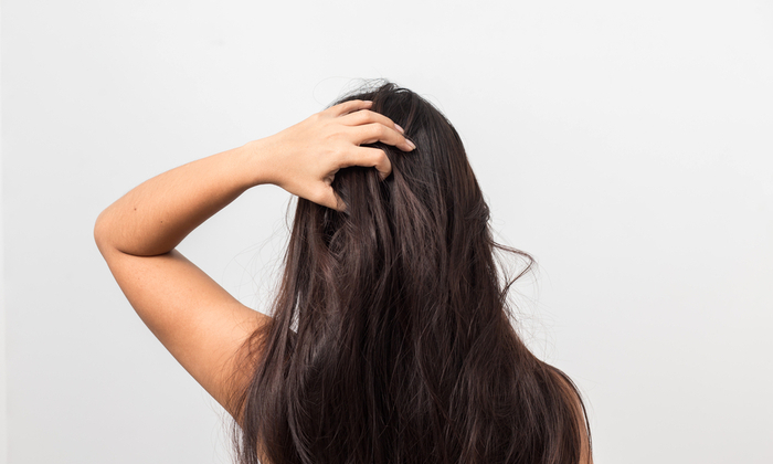 สะเก็ดเงินที่ศีรษะ เกิดจากอะไร และรักษาได้อย่างไร