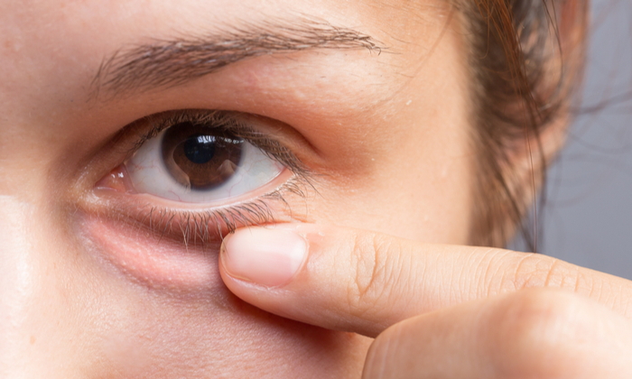 เนื้องอกในตา ลุกลามเป็นมะเร็งได้หรือไม่