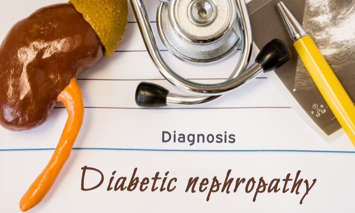 เบาหวานลงไต ปัจจัยเสี่ยง และวิธีดูแลตัวเอง