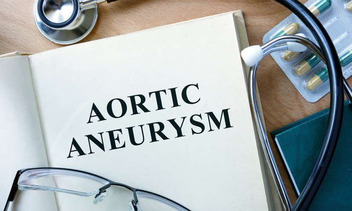 โรคหลอดเลือดแดงใหญ่โป่งพอง (Aortic Aneurysm) สามารถเกิดขึ้นได้จาก สาเหตุใด