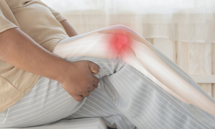 ทำความเข้าใจ โรคอ้วนกับปัญหากระดูก ข้อเข่าเสื่อม