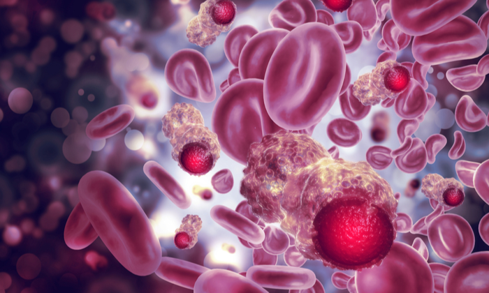 รู้หรือไม่ ภาวะแทรกซ้อนจากมะเร็ง มีอะไรบ้าง