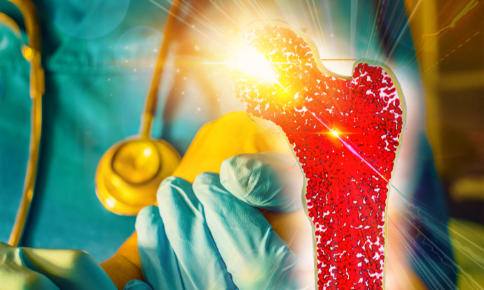 ทำความเข้าใจ การรักษามะเร็งกระดูก ช่วยตัดสินใจในการรักษา