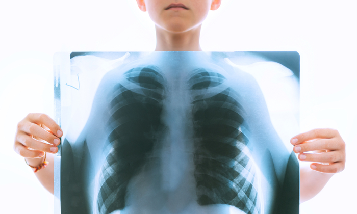 โรคทางเดินหายใจในเด็ก คืออะไร? สร้างปัญหาให้ลูกรักมากแค่ไหน มาดูกัน