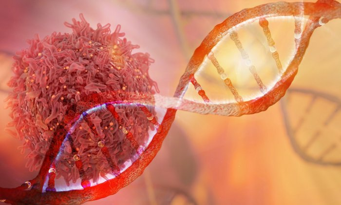 โรคมะเร็งเน็ต อย่าประมาท ถึงพบน้อยแต่ก็คร่าชีวิตได้