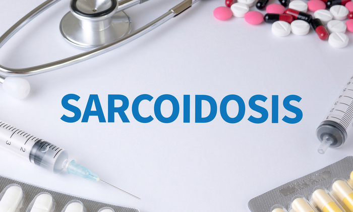 วิธีรักษาโรคซาร์คอยโดซิส ก่อนเสี่ยงเป็นโรคปอดอักเสบแบบแกรนูโลมา