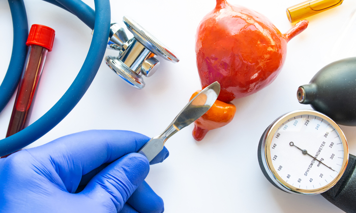 มารู้วิธี การรักษามะเร็งต่อมลูกหมาก ที่อาจมีการรักษามากกว่า 1 วิธี