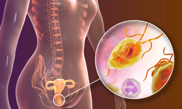 การรักษาโรคพยาธิในช่องคลอด ไม่น่ากลัวอย่างที่คิด