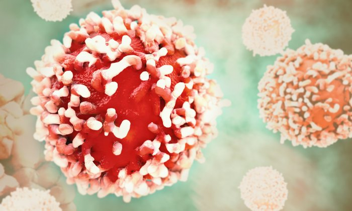 ทำความรู้จักกับ มะเร็งท่อน้ำดี โรคที่หลายคนอาจไม่ค่อยได้ยิน