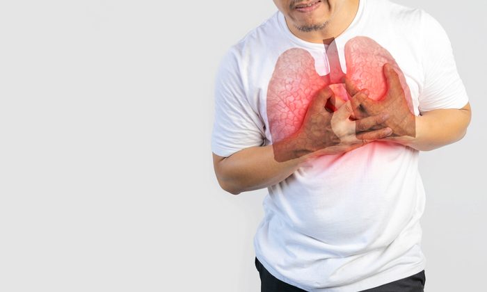 โรคถุงลมโป่งพอง (Emphysema)