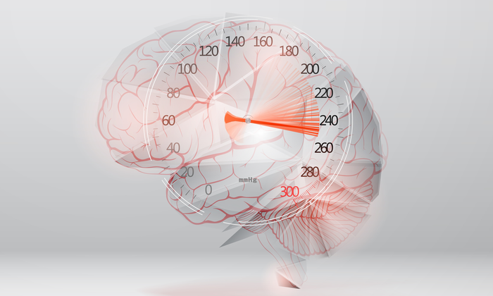 ความดันโลหิตสูง สร้างความเสียหายต่อ สมอง ของคุณอย่างไรบ้าง