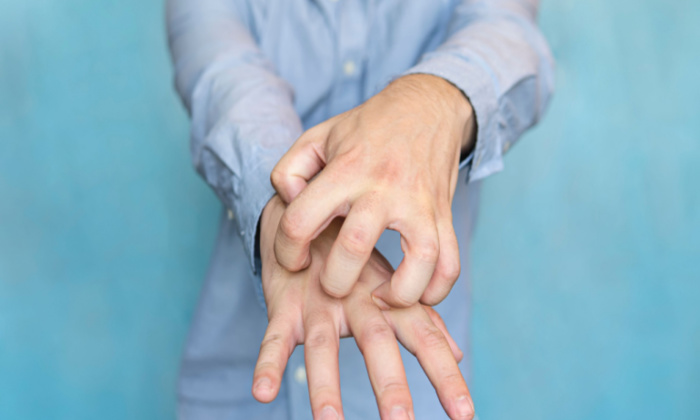 การติดเชื้อไวรัสที่ผิวหนัง สาเหตุเกิดจากอะไร ส่งผลอย่างไรต่อสุขภาพ