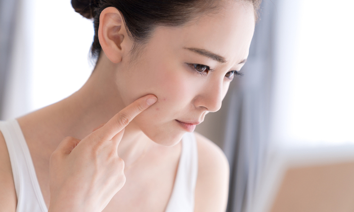 ตำแหน่งสิว บอกอะไรเกี่ยวกับปัญหาสุขภาพได้