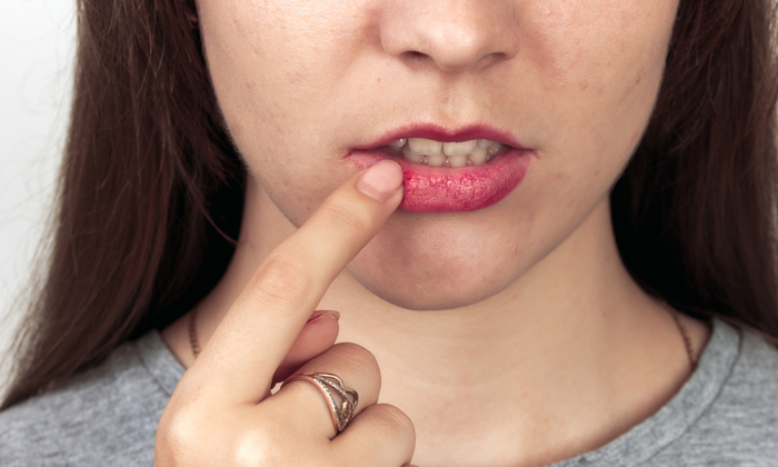 ทำความรู้จักกับ เชื้อไวรัสเฮอร์พีส์ ซิมเพล็กซ์