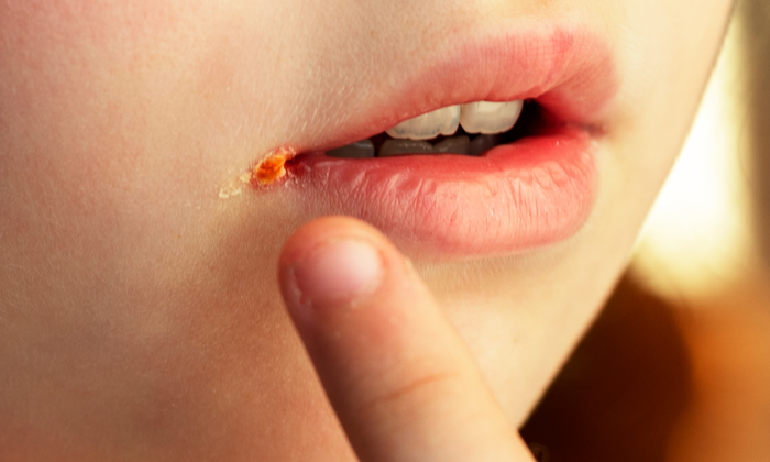 ปากนกกระจอก