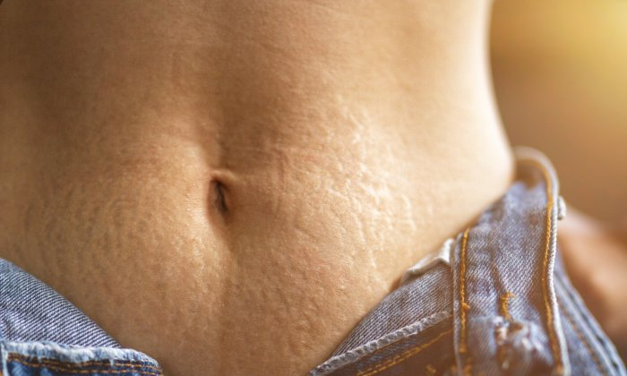 ท้องลาย อาการ สาเหตุ และวิธีการรักษา