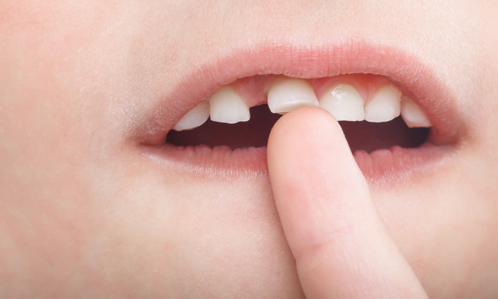 ฟันโยก สาเหตุ วิธีรักษาและป้องกัน