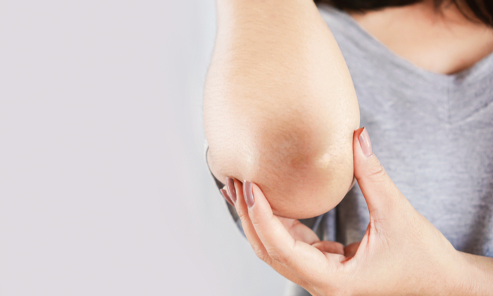 ข้อศอกด้าน สาเหตุ การดูแลและการป้องกัน