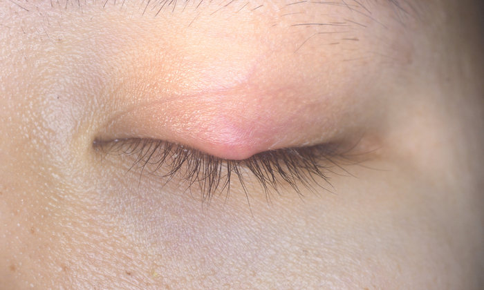 ตากุ้งยิง