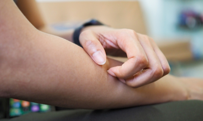 ผดร้อน อาการ สาเหตุ และการรักษา