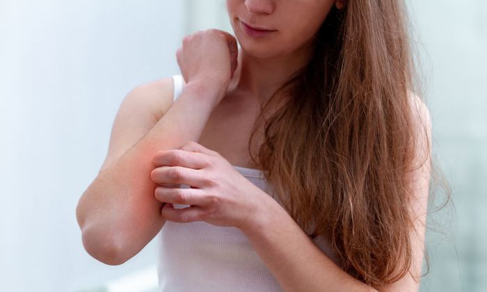 ผื่น อาการ สาเหตุ การรักษา