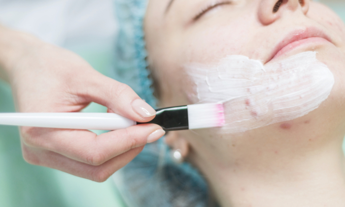 รักษาสิวอุดตัน ควรทำอย่างไร และการป้องกันสิวอุดตัน