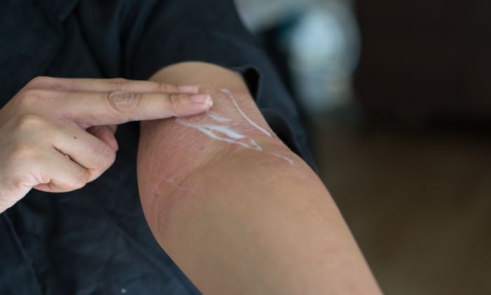 ผื่นขึ้นตามตัว เกิดจากสาเหตุอะไร