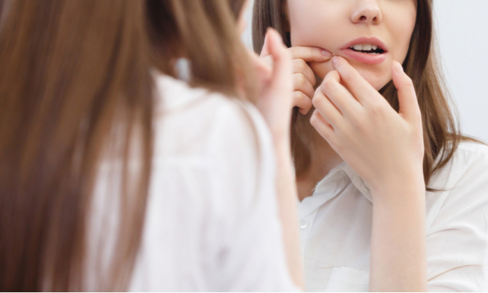 สิว อาการ สาเหตุ และการรักษา