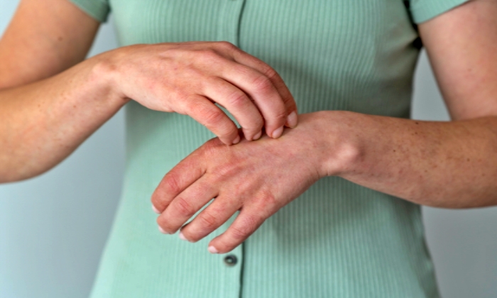 หูด ลักษณะ สาเหตุ วิธีรักษาและวิธีป้องกัน