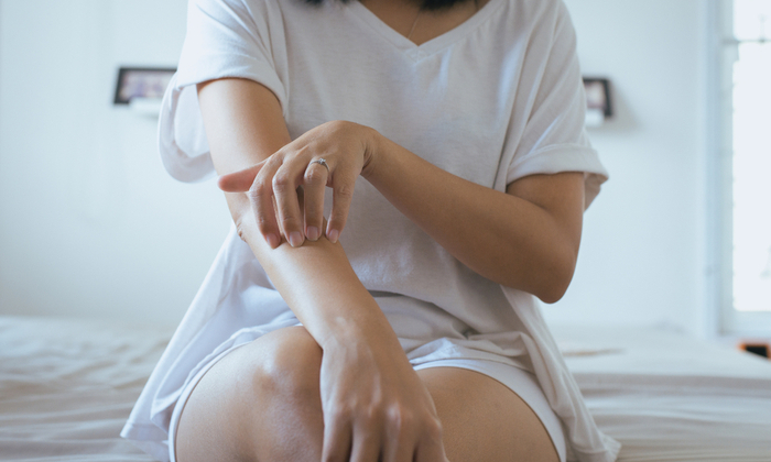 โรคสะเก็ดเงินเกิดจากอะไร จะรู้ได้อย่างไรว่าเป็นโรคสะเก็ดเงิน