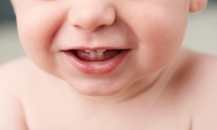 ปากแหว่งเพดานโหว่ อาการ สาเหตุ การรักษา