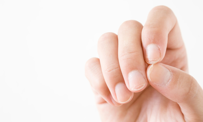 เชื้อราที่เล็บ อาการ สาเหตุ ปัจจัยเสี่ยง และวิธีรักษารักษา