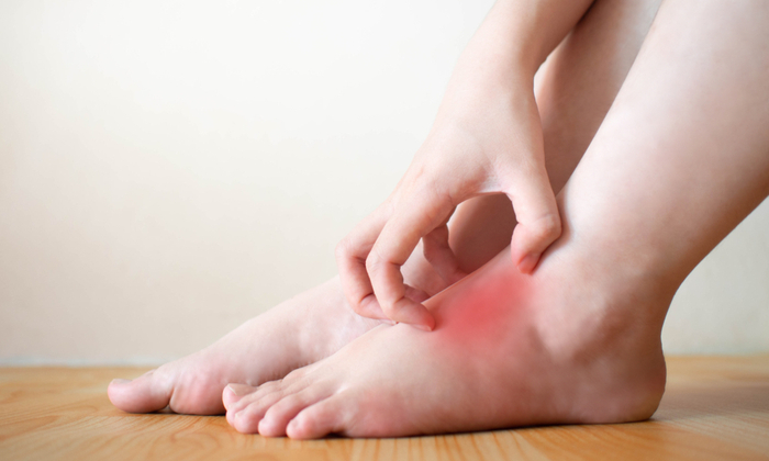 ไฟลามทุ่ง อาการ สาเหตุและการรักษา