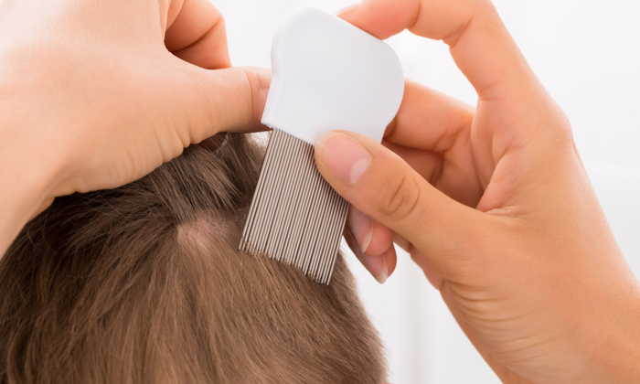 เหา อาการ สาเหตุ และการรักษา