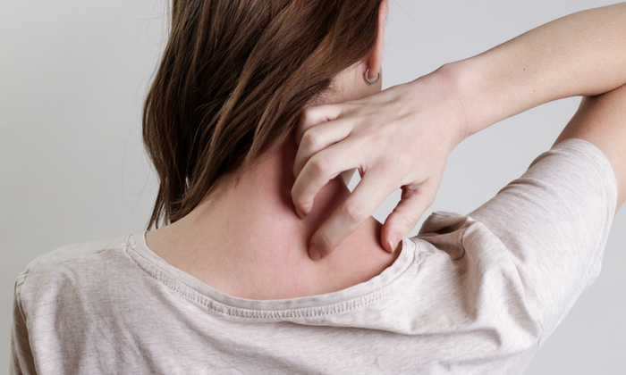 งูสวัดกี่วันหาย อาการ สาเหตุ และการรักษา