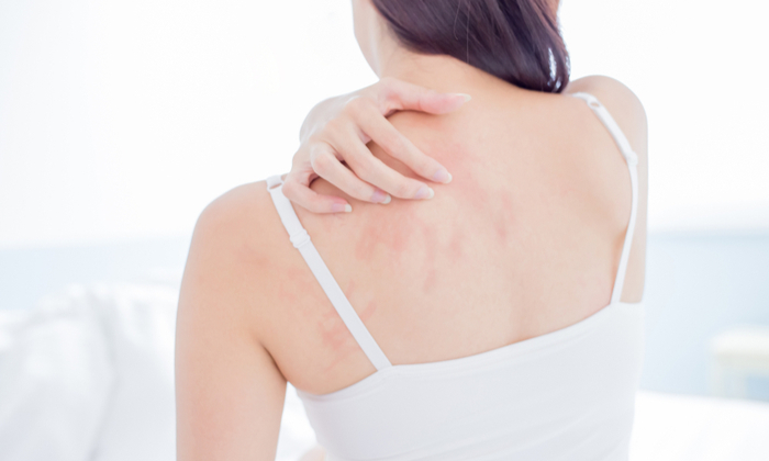 คันตามตัว เกิดจากสาเหตุอะไรได้บ้าง