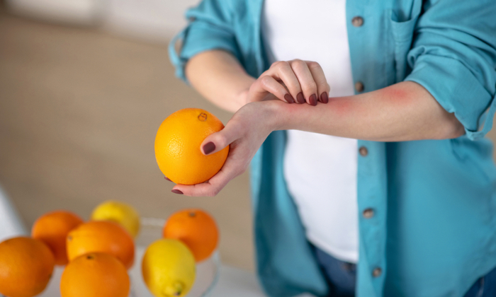 5 สาเหตุของ ผื่นลมพิษ ขณะตั้งครรภ์ และวิธีการรักษา