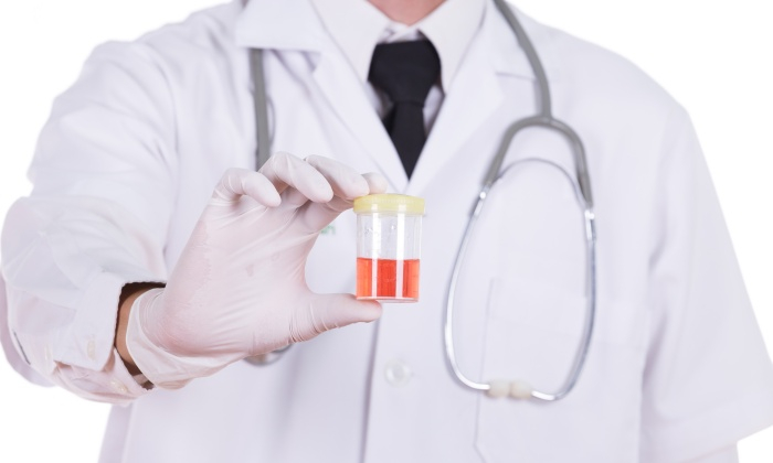 ฉี่มีเลือดปน สาเหตุและการรักษา