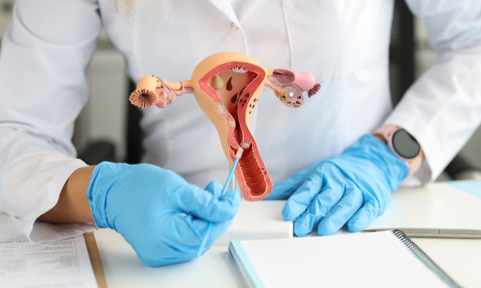 ทำไมต้อง ตัดมดลูกและรังไข่ 2 ข้าง