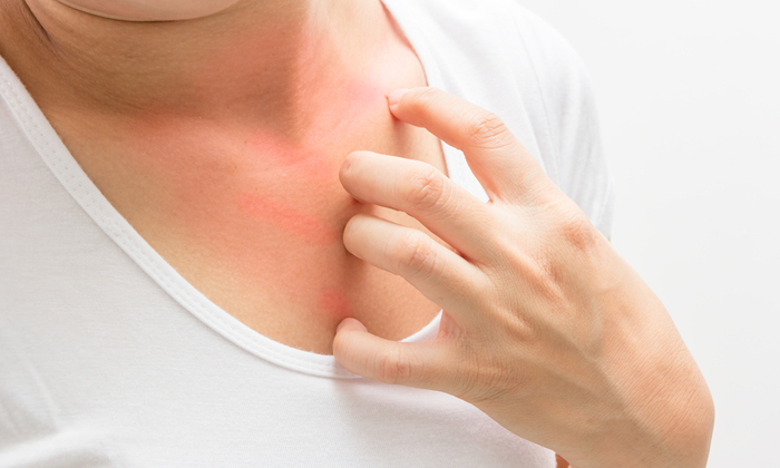 ภูมิแพ้ผิวหนัง สาเหตุ อาการ และการรักษา