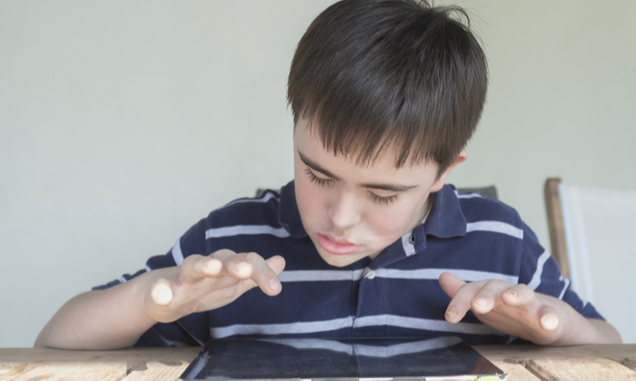 โรคดาวน์ซินโดรม (Down Syndrome) สาเหตุ อาการ การรักษา