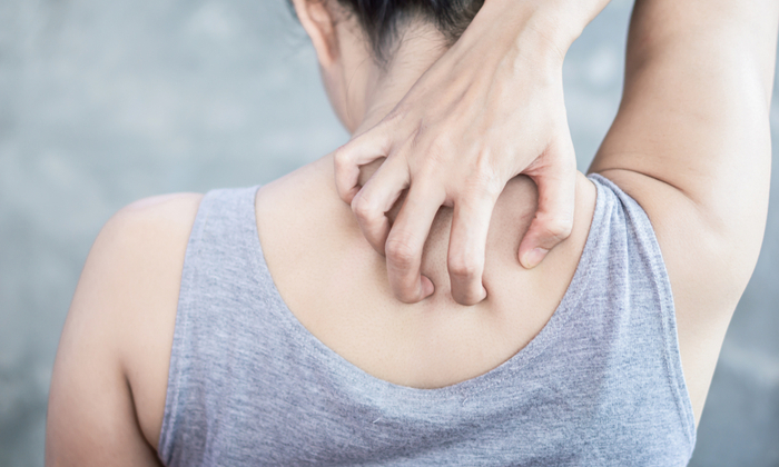 เชื้อราบนผิวหนัง เป็นสาเหตุของโรคอะไรบ้าง ป้องกันได้อย่างไร