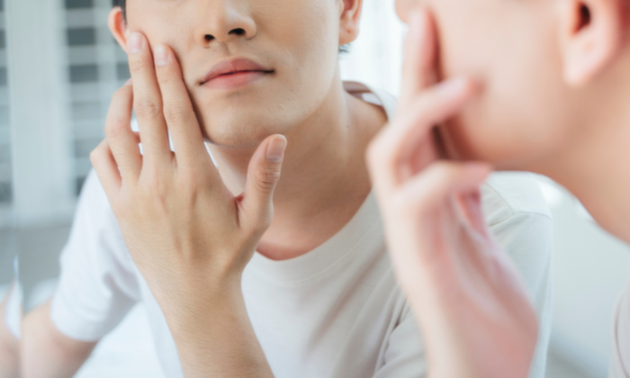 วิธีรักษาสิวผด และการป้องกัน