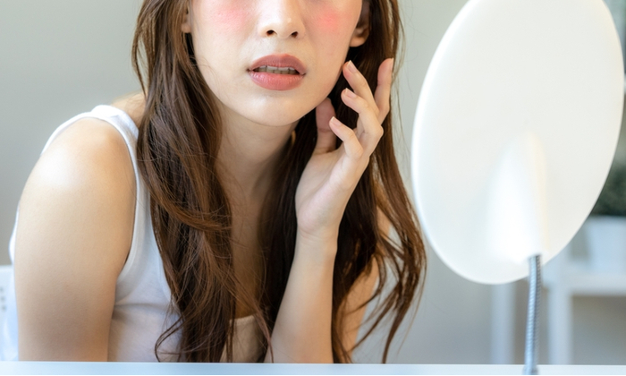 สารสเตียรอยด์ในครีม อันตรายต่อผิวอย่างไร