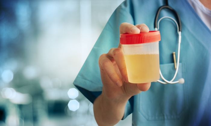 ฉี่เป็นฟอง อันตรายหรือไม่ มีสาเหตุมาจากอะไร