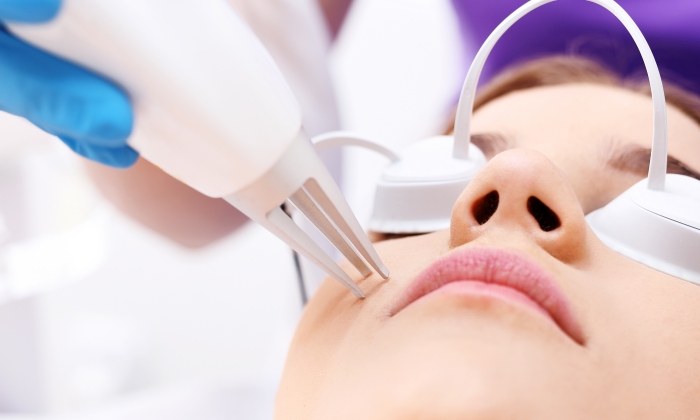 เลเซอร์หลุมสิว คืออะไร มีผลข้างเคียงอย่างไรบ้าง